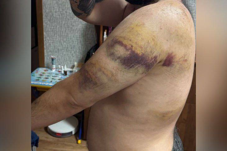 Подростки избили мужчину, заступившегося за девушку на остановке «Юбилейный» в Волгограде
