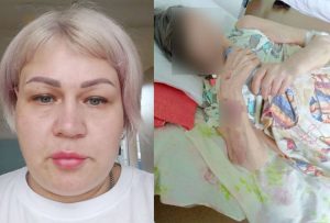 Волгоградка сообщила о бесчеловечных условиях в больнице №4