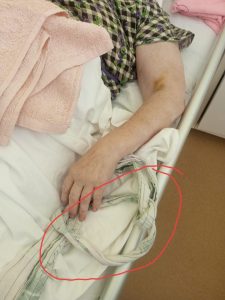 Родственники парализованной женщины во Волжском пожаловались на жестокое обращение в больнице
