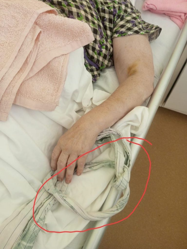 Родственники парализованной женщины во Волжском пожаловались на жестокое обращение в больнице