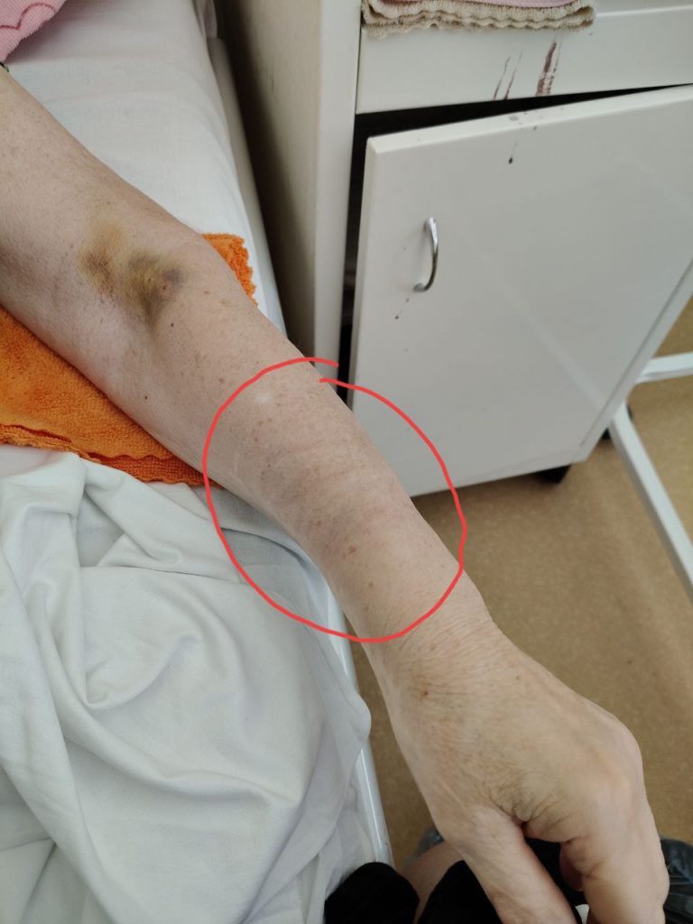 Родственники парализованной женщины во Волжском пожаловались на жестокое обращение в больнице