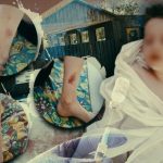 Отдых обернулся больницей: 8-летний мальчик попал на операционный стол после поездки в волгоградский лагерь