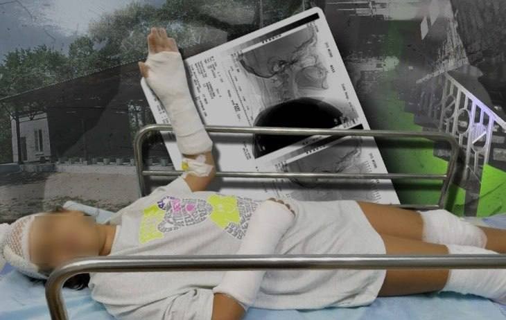 В лагере в Городищенском районе Волгоградской области 9-летняя девочка упала с высоты около 2 метров