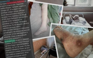 «Переломы, обезвоживание и пролежни»: экс-медсестра заявила о нарушениях в доме престарелых в Волжском