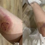 Бродячие собаки напали на 25-летнюю женщину в Кировском районе Волгограда