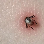 Опасные «наноклещи» атакуют жителей Волгоградской области