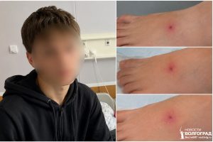 Седьмой случай в регионе: школьник оказался в реанимации после укуса ядовитого паука