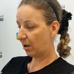 Мать подростка-инвалида из Волжского рассказала об издевательствах над сыном в больнице